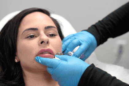 dermal-filler