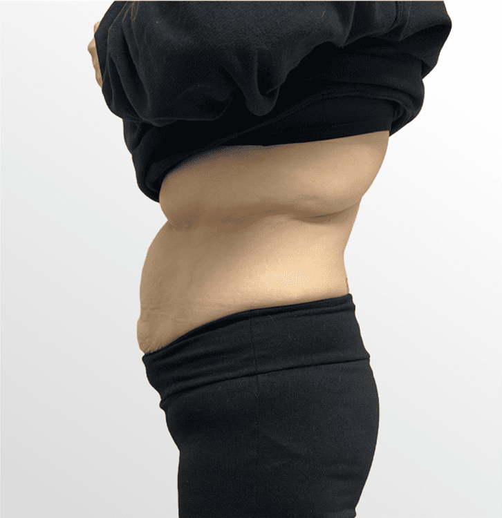 mebership body after