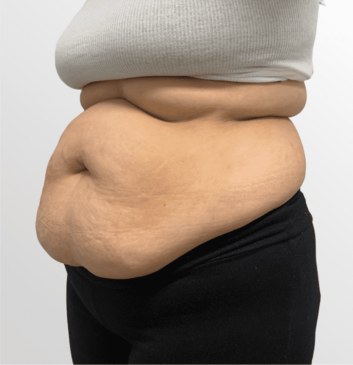 mebership body before