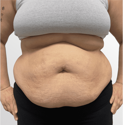 mebership glp before