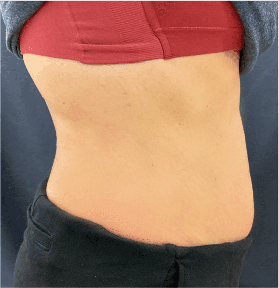 mebership glp2 after