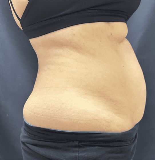 mebership glp2 before