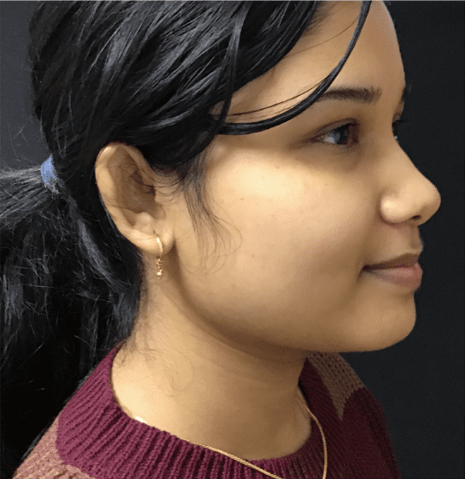 membership after image