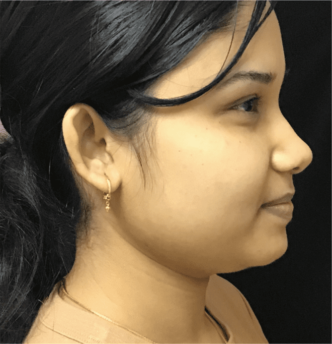 membership before image