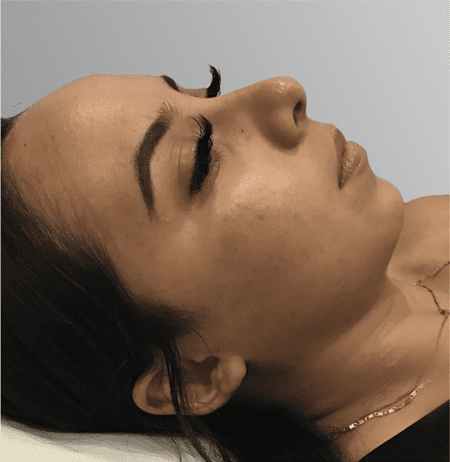 membership gold after