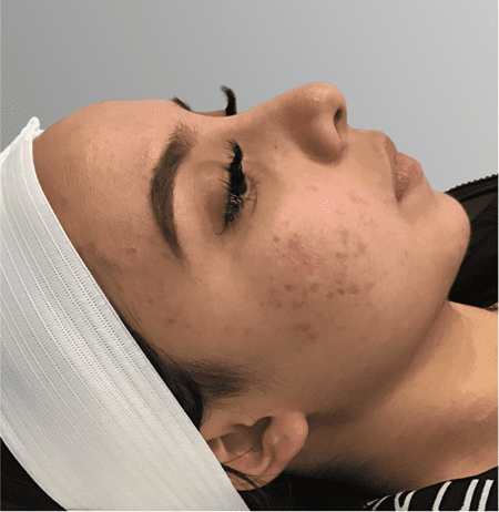 membership gold before