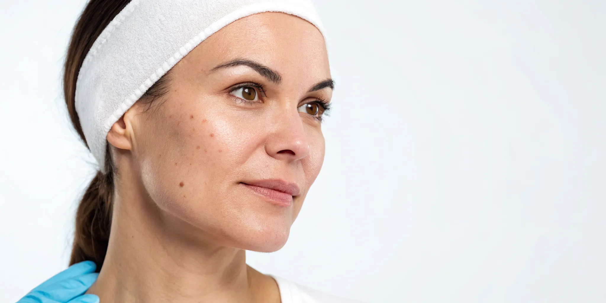 Woman with fresh, glowing skin experiencing minimal downtime after microneedling.