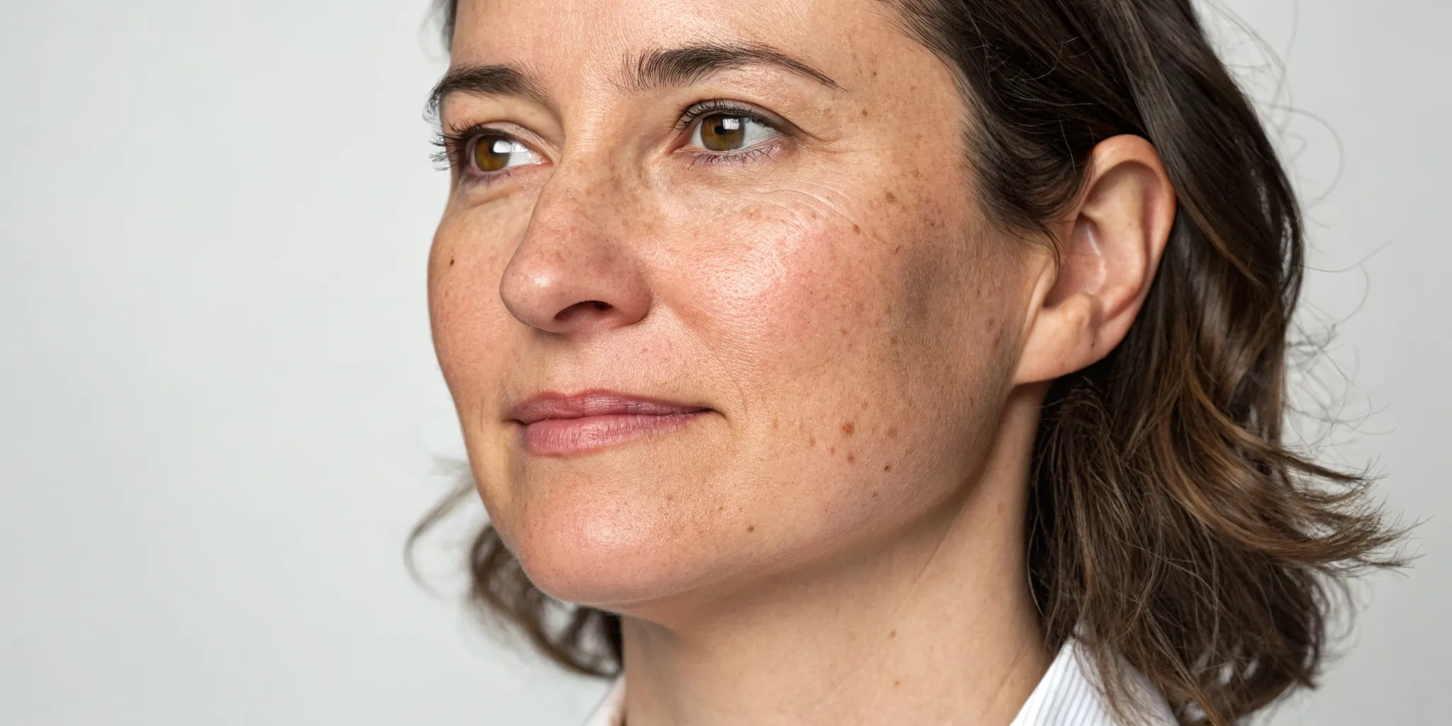 Before photo of a woman's chin for a laser hair removal before and after comparison.